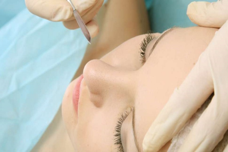 Manfaat Operasi  Plastik untuk Tujuan Estetika yang Harus Anda Ketahui