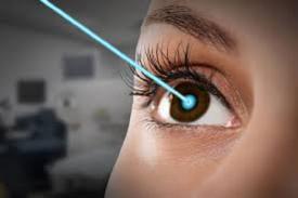 Teknologi LASIK Terbaru, Aman, Cepat, dan Nyaman