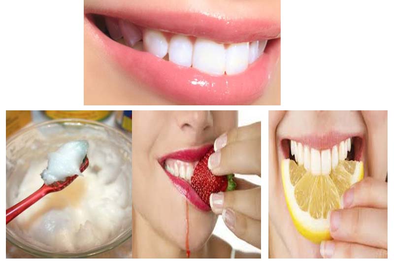 Cara Penggunaan Bahan Alami Untuk Memutihkan Gigi