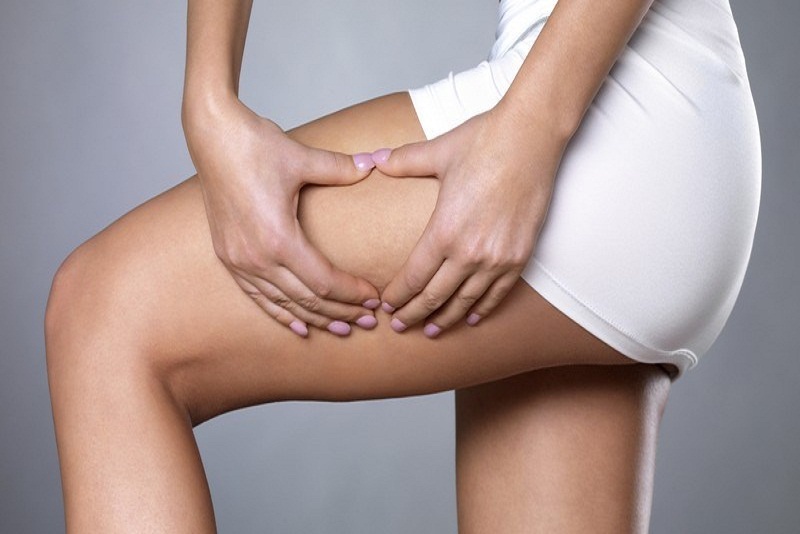 Bahan-Bahan Alami yang Ampuh Hilangkan Selulit