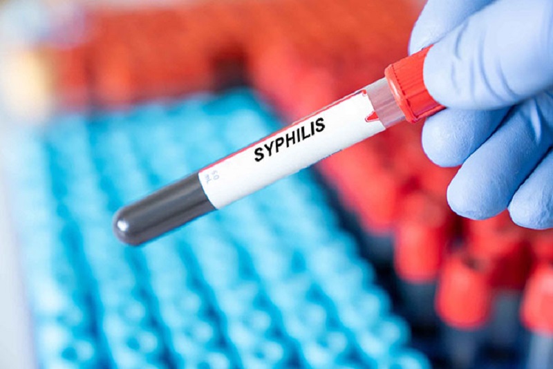 Kenali 8 Gejala Sifilis pada Wanita