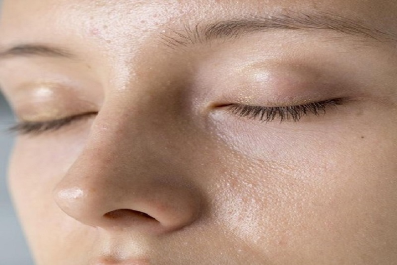 Selain Bikin Pori-Pori Membesar, Ini Akibat Bila Malas Membersihkan Makeup Sebelum Tidur